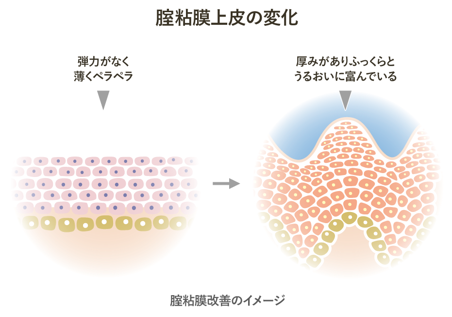 腟粘膜上皮の変化